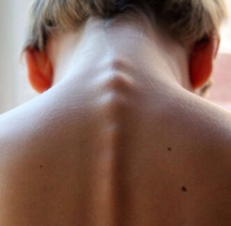 Harnessing Technology and Forensic Evidence for Effective Spinal Cord Injury Cases